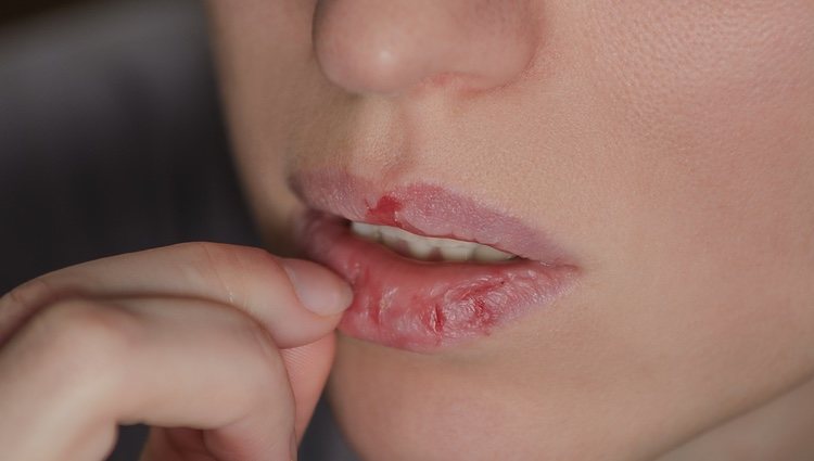 Elimina la manía de tocar y humedecer los labios