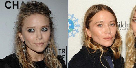 Mary-Kate Olsen antes y después de operarse