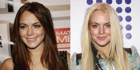 Lindsay Lohan antes y después de operarse