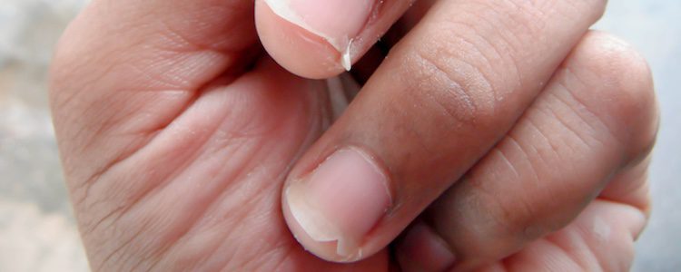 Puedes tener las uñas frágiles por la falta de vitaminas o minerales
