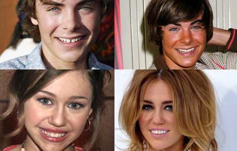 Zac Efron y Miley Cirus antes y después