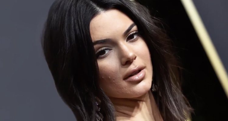 Kendall Jenner apareció en los Globos de Oro 2018 con acné