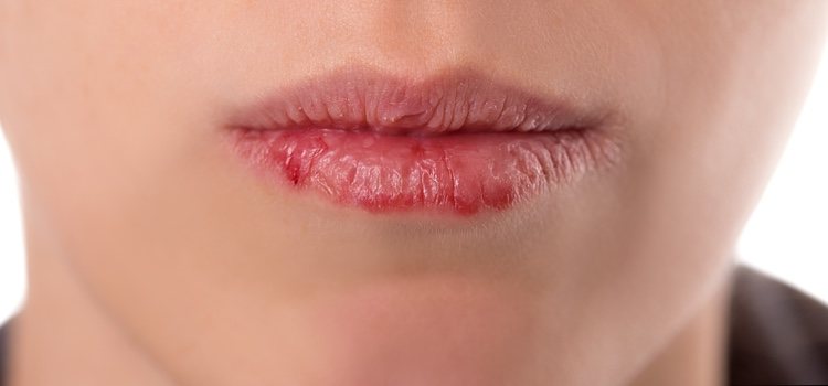 La hidratación es fundamental para el buen estado de nuestros labios