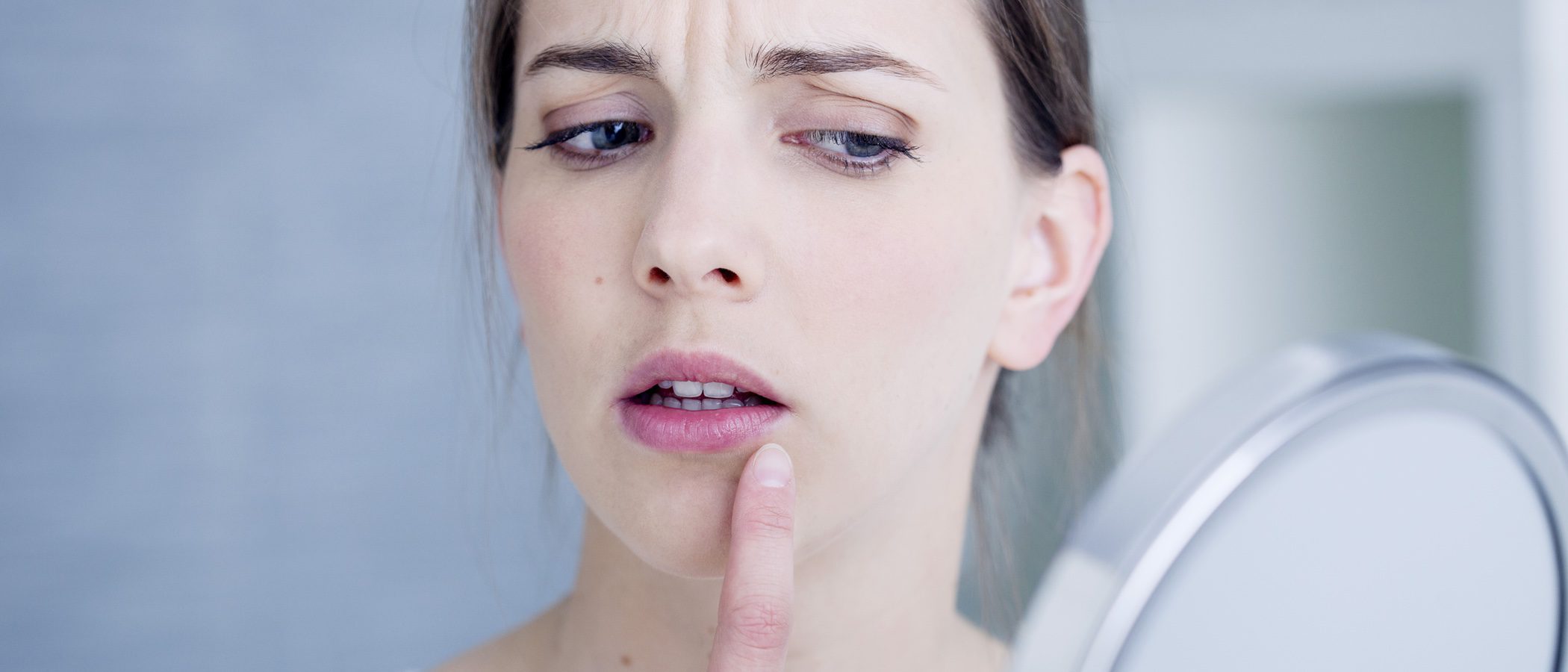 Herpes en la cara: causas de su aparición