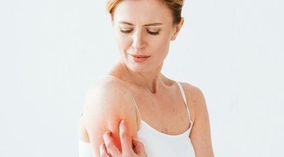 Picazón en la piel: las causas de los picores