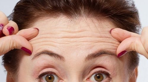Rellenador de arrugas: qué es y cómo funciona