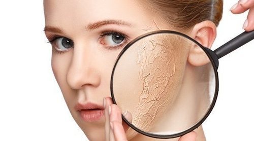 Piel seca: consejos para evitar la sequedad de tu piel