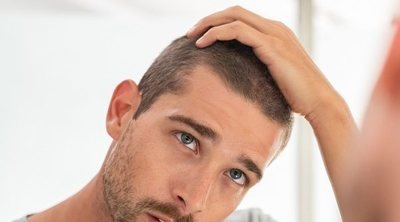 Cómo luchar contra la calvicie masculina: Mitos y realidades