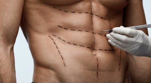 Cirugía estética para hombres: ¿qué me opero?