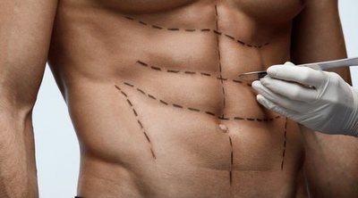 Cirugía estética para hombres: ¿qué me opero?