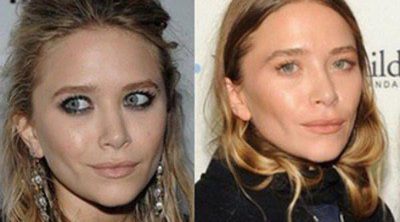 Mary-Kate Olsen y otras famosas que se operaron radicalmente el rostro