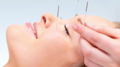 Suaviza tus arrugas con la acupuntura cosmética