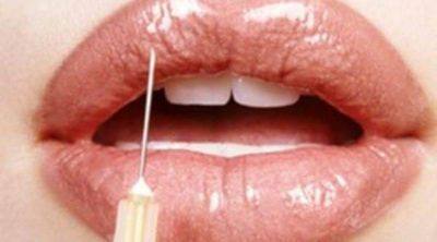 Aumento de labios: tipos de operaciones y riesgos