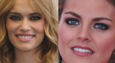 La sonrisa de las celebrities: el antes y el después tras su paso por el dentista