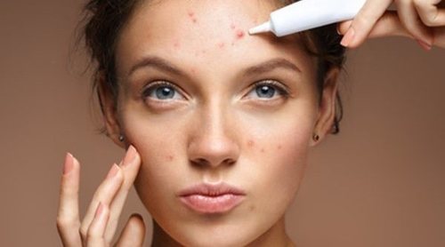 Cómo maquillarse cuando tienes manchas en la cara