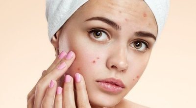Cómo maquillarse cuando tienes acné