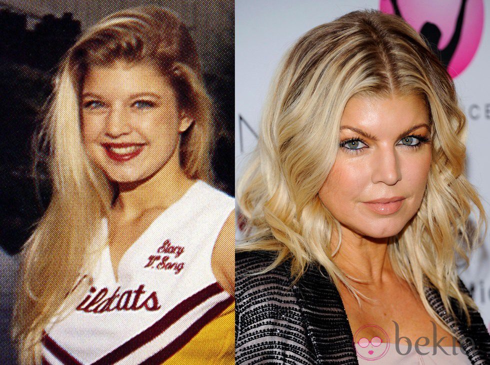 El antes y el después de Fergie