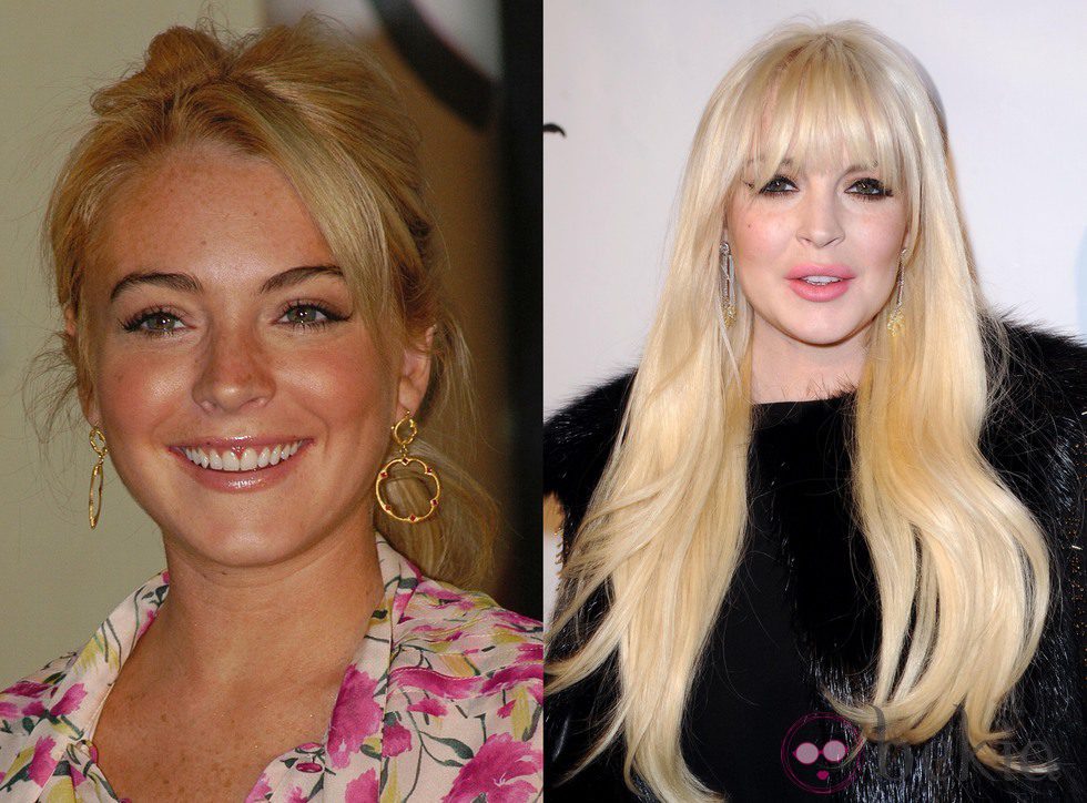 El antes y el después de Lindsay Lohan